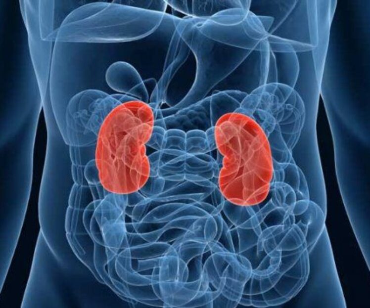 Kidney Disease